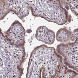 CXCR7/RDC-1 Antibody, Novus Biologicals:Antibodies:Primary Antibodies